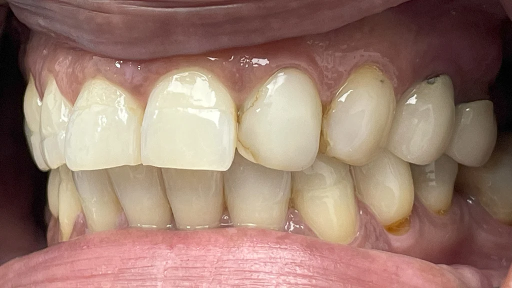 Dental Famidental of Burke