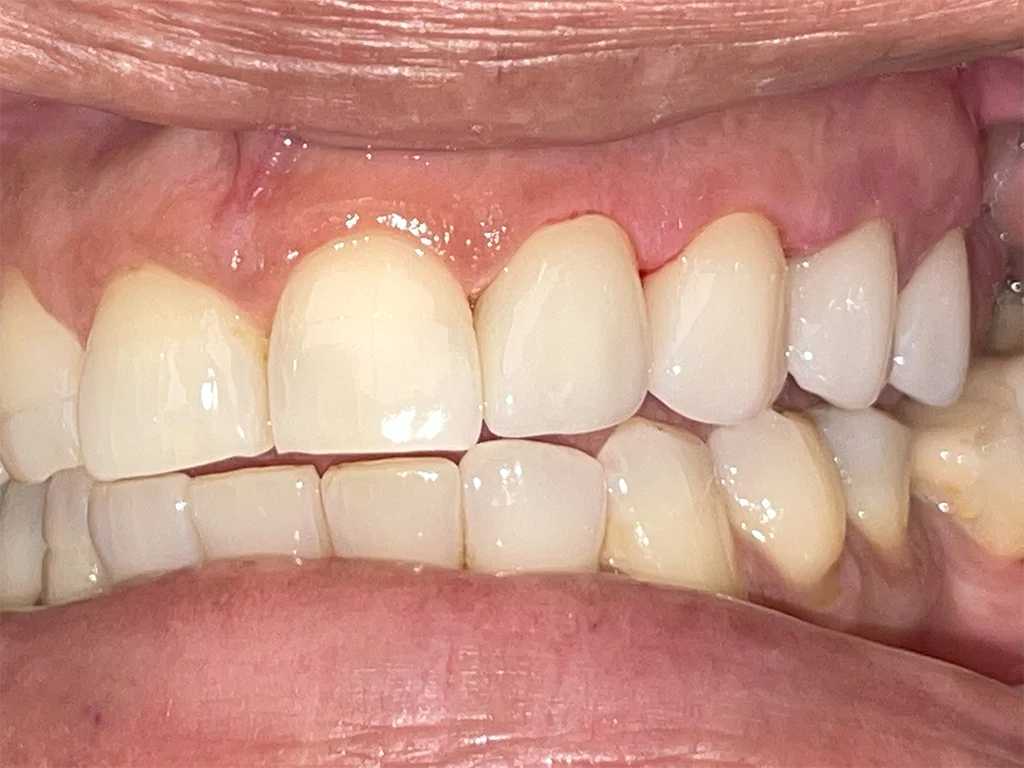 Dental Care at Luxe Smiles, Palmetto Bay, Miami