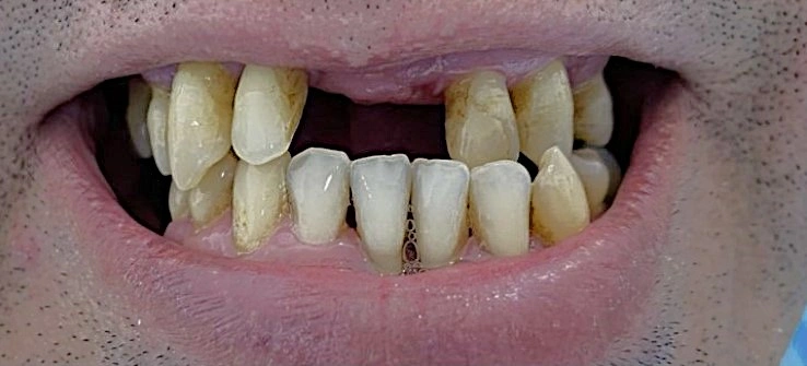 Dental Famidental of Burke
