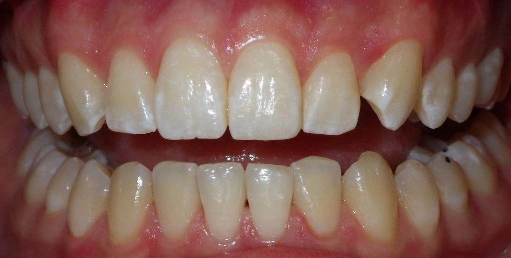 Dental Famidental of Burke